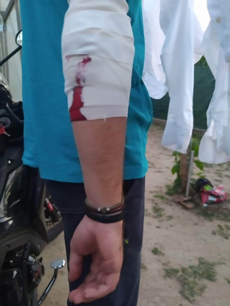 Σπιάντζα: Στο νοσοκομείο δύο άτομα από επίθεση αγέλης σκύλων