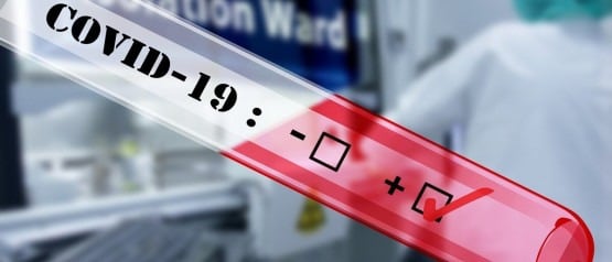 5 νέα κρούσματα σήμερα στην Ηλεία. Ψηλά και πάλι η Αχαΐα με 29.